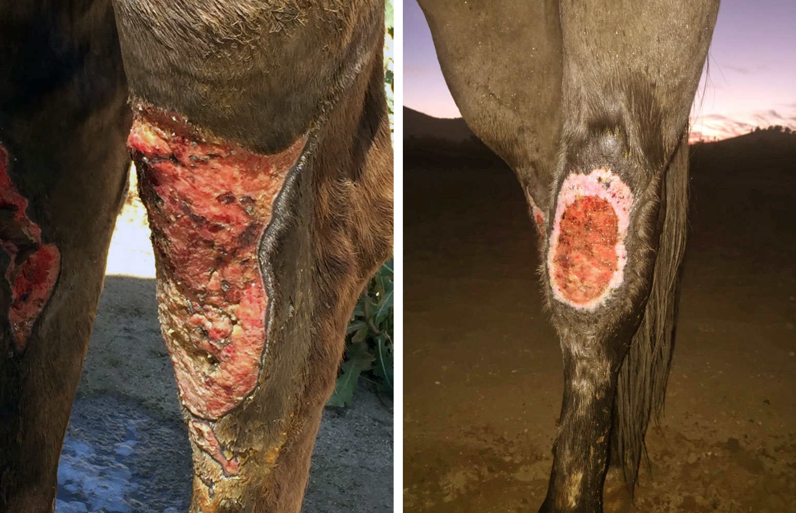 Non-healing wound responds with shockwave treatment, before and after
